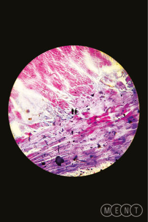 Eva Popit x Katarzia _ Isama Zing (appointMENT 4.0)